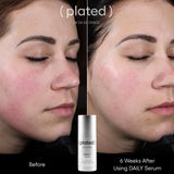 Plated Daily Serum