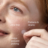 Invisiclear Hydrocolloid Spot Patches