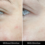 Omnilux Contour Face