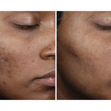 Ourself Complexion Brightening Serum