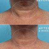 Ourself Advanced Regenerative Serum