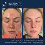 Restorative HA Serum